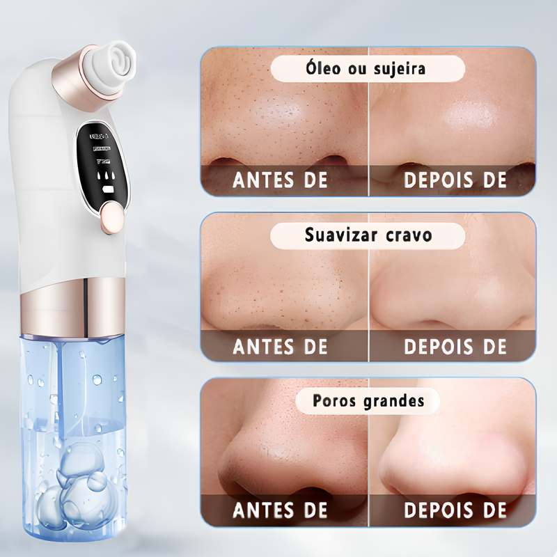 Aparelho Portátil de Limpeza Facial Clear Face